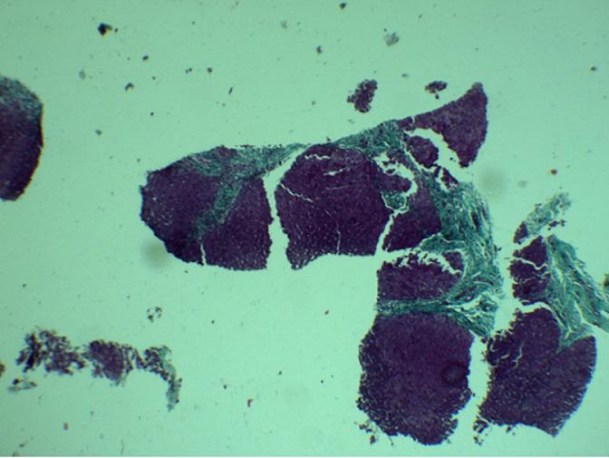 https://cdn.ncbi.nlm.nih.gov/pmc/blobs/422d/8106784/b132acb3ffe1/PAMJ-38-188-g001.jpg
