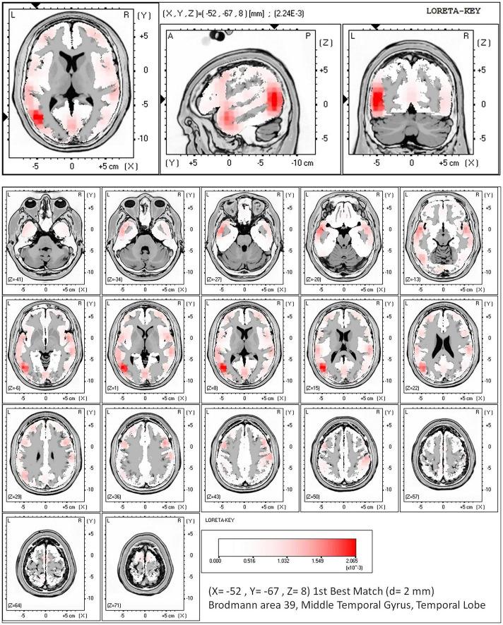 https://cdn.ncbi.nlm.nih.gov/pmc/blobs/422d/9019658/f926f4ba09b4/fnhum-16-782496-g004.jpg