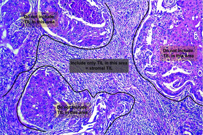 https://cdn.ncbi.nlm.nih.gov/pmc/blobs/4233/7820903/495b57376b2b/fonc-10-611571-g003.jpg