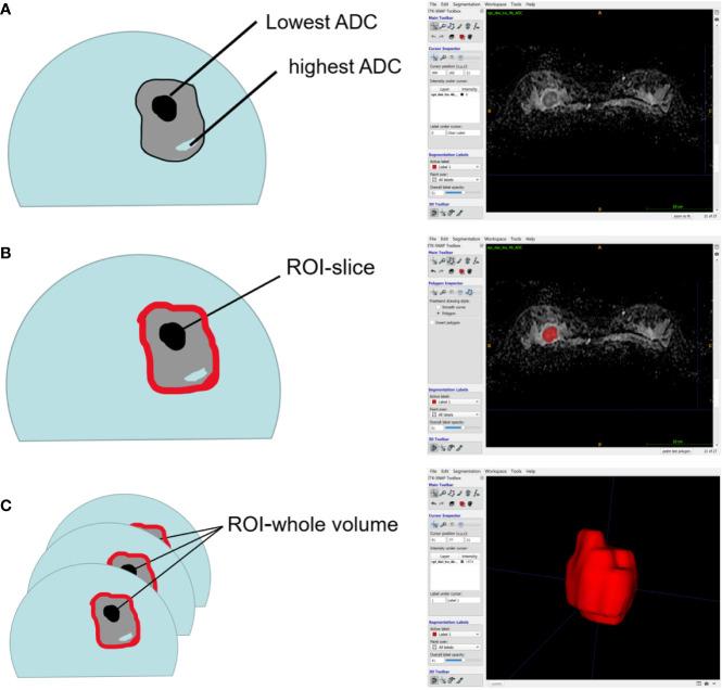 https://cdn.ncbi.nlm.nih.gov/pmc/blobs/4233/7820903/cccd9a219654/fonc-10-611571-g002.jpg
