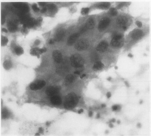 https://cdn.ncbi.nlm.nih.gov/pmc/blobs/4237/494967/637bfe8e088f/jclinpath00414-0032-b.jpg