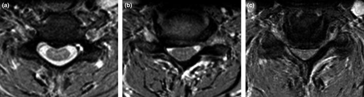 https://cdn.ncbi.nlm.nih.gov/pmc/blobs/4242/5607559/6f56b0bf0a26/BRB3-7-e00797-g001.jpg