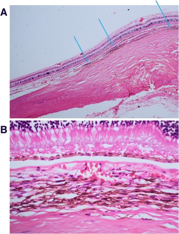 https://cdn.ncbi.nlm.nih.gov/pmc/blobs/4247/6297940/fe4d0f1c303f/12885_2018_5190_Fig2_HTML.jpg