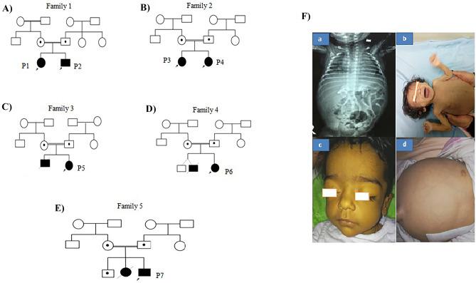 https://cdn.ncbi.nlm.nih.gov/pmc/blobs/4252/10517033/e048f90859c2/12031_2023_2139_Fig1_HTML.jpg