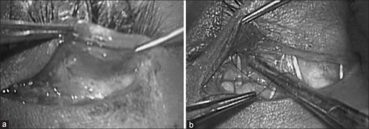 https://cdn.ncbi.nlm.nih.gov/pmc/blobs/4256/11573011/26f1b4bdf418/IJO-72-1512-g001.jpg