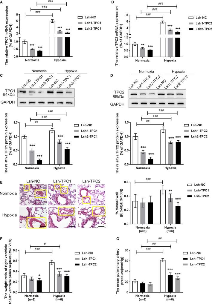 https://cdn.ncbi.nlm.nih.gov/pmc/blobs/4259/8335677/be74aecee9d2/JCMM-25-7485-g002.jpg