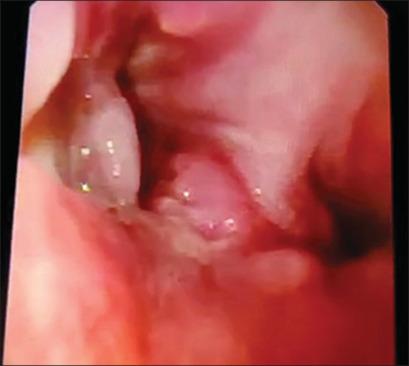 https://cdn.ncbi.nlm.nih.gov/pmc/blobs/425c/10883443/7cca0222b420/LI-41-63-g001.jpg