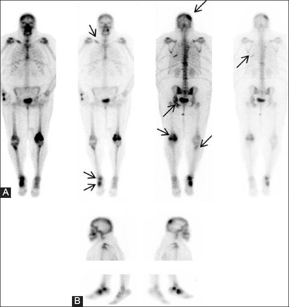 https://cdn.ncbi.nlm.nih.gov/pmc/blobs/426d/4531454/1395d30a6579/IJRI-25-284-g005.jpg