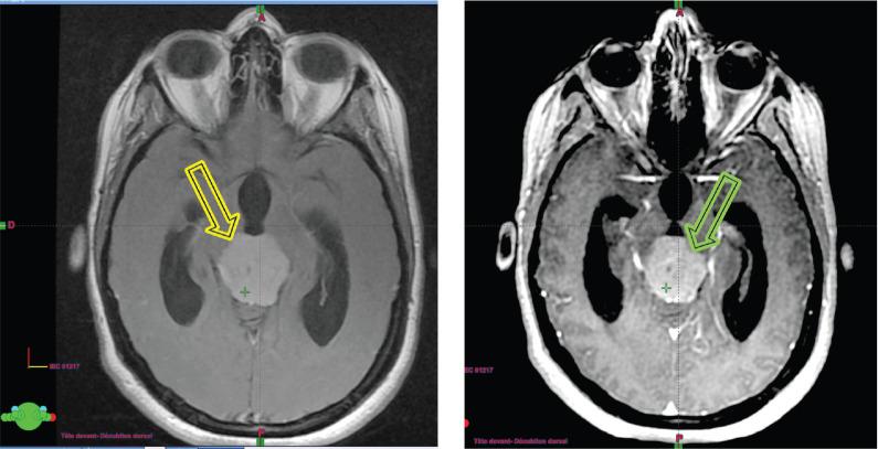 https://cdn.ncbi.nlm.nih.gov/pmc/blobs/4272/12185867/4fc590345ae6/can-19-1909fig2.jpg