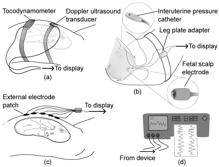 https://cdn.ncbi.nlm.nih.gov/pmc/blobs/4274/10525263/1afa07e91108/bioengineering-10-01007-g002.jpg