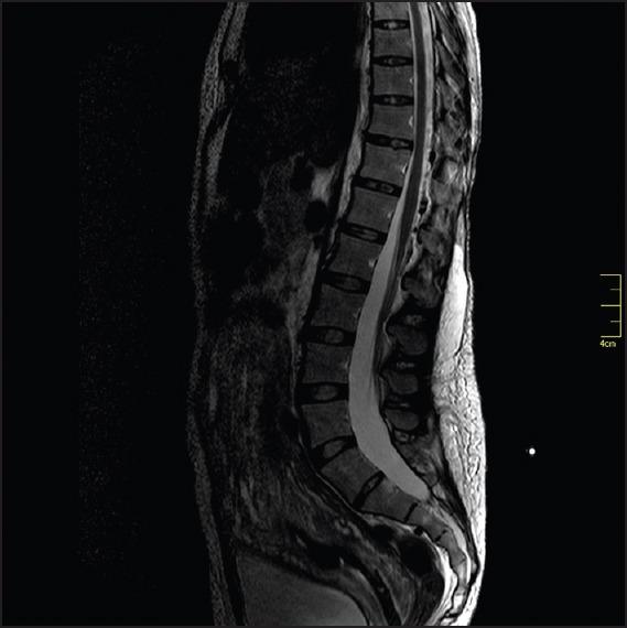 https://cdn.ncbi.nlm.nih.gov/pmc/blobs/427f/4610097/32336f04cc99/SJA-9-467-g001.jpg