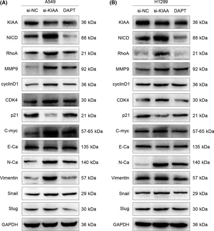 https://cdn.ncbi.nlm.nih.gov/pmc/blobs/4280/5891195/99db0c47f41c/CAS-109-1055-g006.jpg