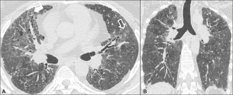 https://cdn.ncbi.nlm.nih.gov/pmc/blobs/4280/6198836/213733b91ed2/rb-51-05-0321-g03.jpg