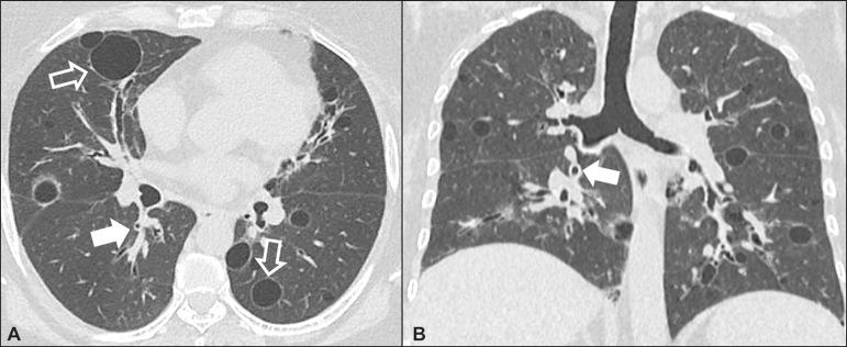 https://cdn.ncbi.nlm.nih.gov/pmc/blobs/4280/6198836/3b50f5ce9f73/rb-51-05-0321-g07.jpg