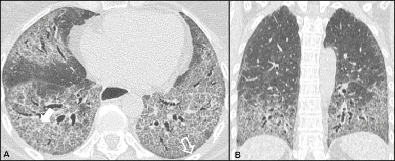 https://cdn.ncbi.nlm.nih.gov/pmc/blobs/4280/6198836/4d0f5063c3a1/rb-51-05-0321-g02.jpg