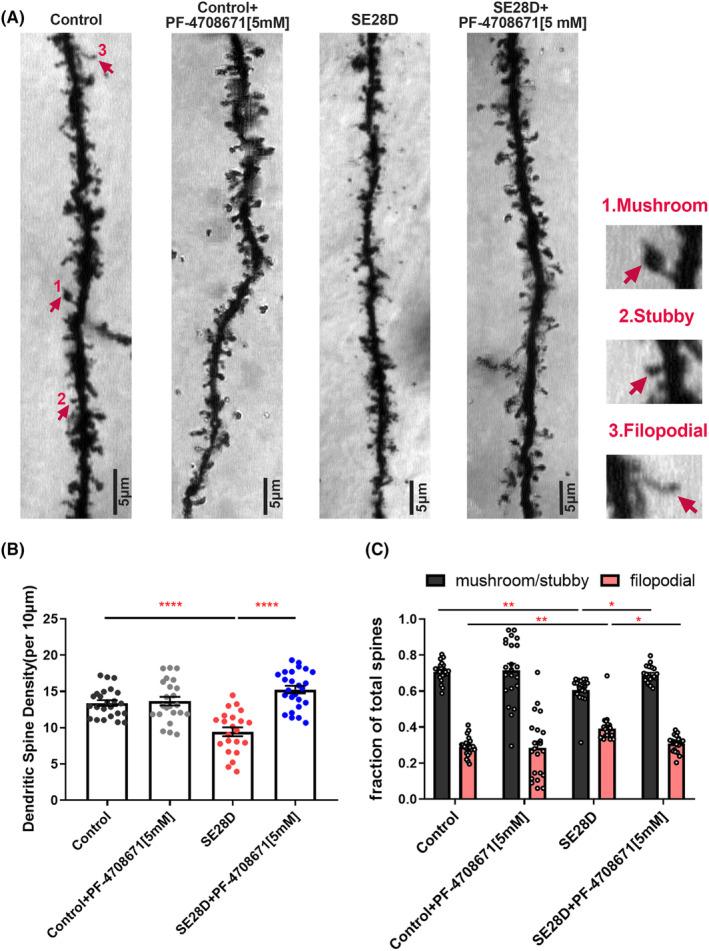 https://cdn.ncbi.nlm.nih.gov/pmc/blobs/4281/10945394/5602f39ef8cf/CNS-30-e14475-g001.jpg
