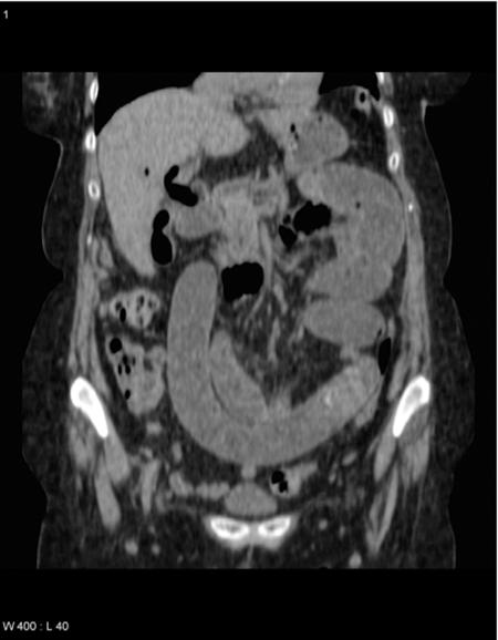 https://cdn.ncbi.nlm.nih.gov/pmc/blobs/4282/3043585/462deefe1233/jls0021026160007.jpg