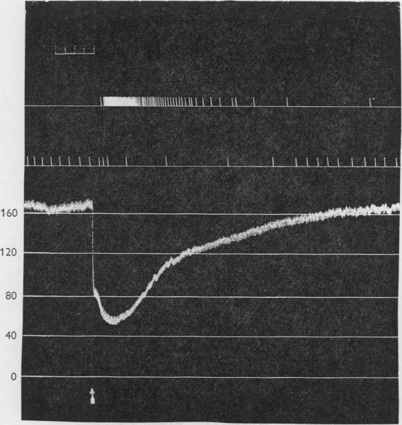 https://cdn.ncbi.nlm.nih.gov/pmc/blobs/4283/1365509/0a3ce3d65bc3/jphysiol01114-0030-a.jpg