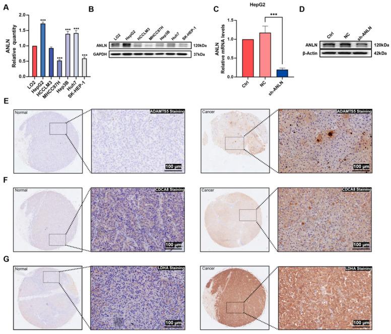 https://cdn.ncbi.nlm.nih.gov/pmc/blobs/4290/12249396/e2706481860c/cancers-17-02220-g004.jpg