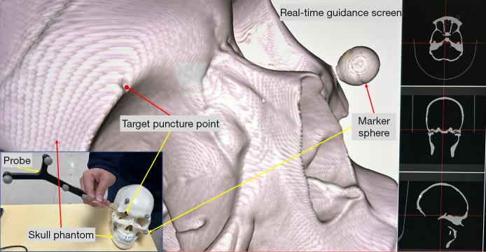 https://cdn.ncbi.nlm.nih.gov/pmc/blobs/4293/12397674/d27acb9a263c/qims-15-09-8023-f4.jpg