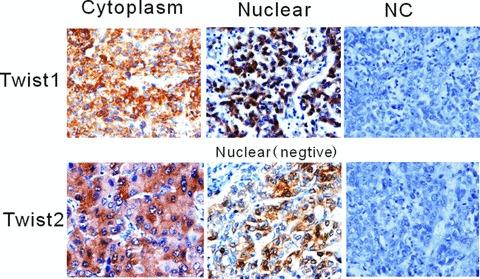https://cdn.ncbi.nlm.nih.gov/pmc/blobs/4299/3922390/34bb001d867e/jcmm0015-0691-f1.jpg