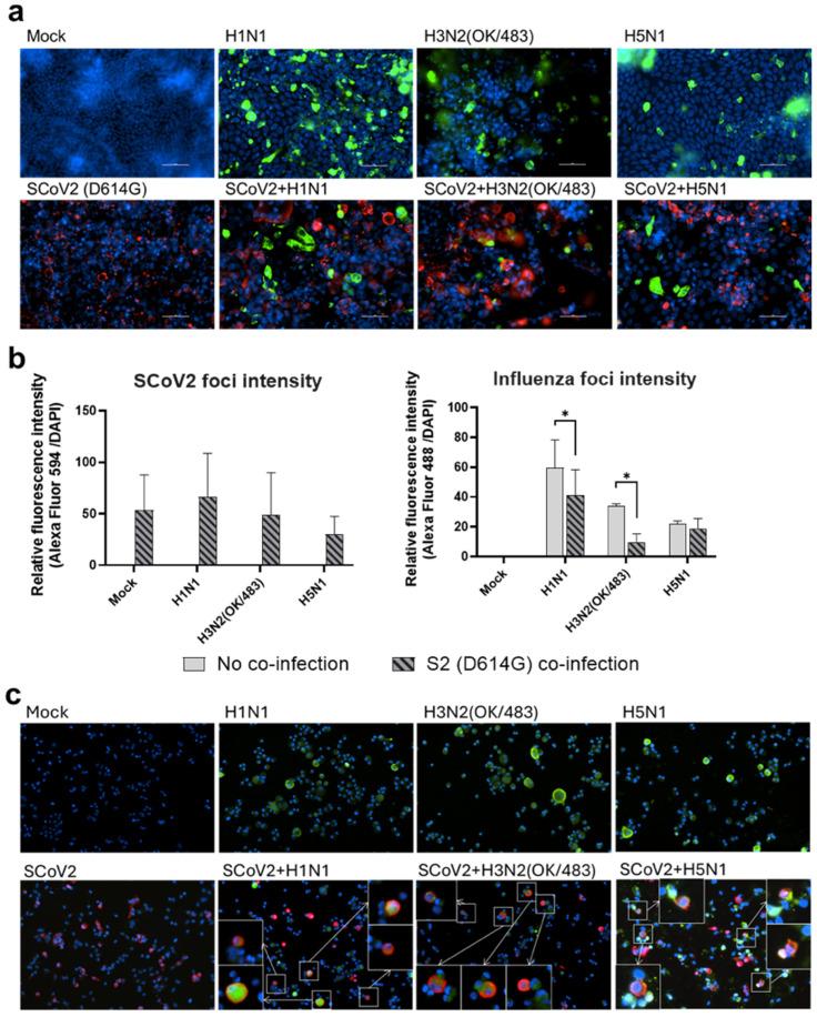 https://cdn.ncbi.nlm.nih.gov/pmc/blobs/429e/12114508/1b2e219ee822/microorganisms-13-00988-g004.jpg