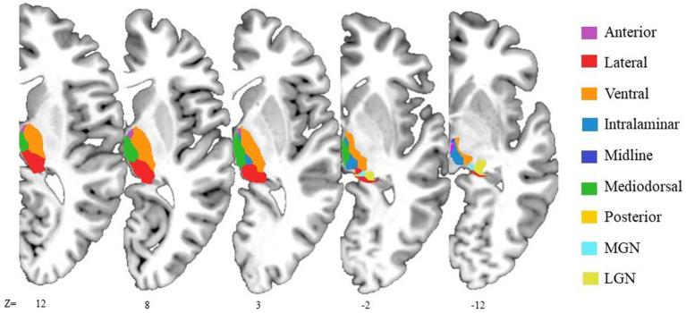 https://cdn.ncbi.nlm.nih.gov/pmc/blobs/429f/12241866/0df415f1c393/fneur-16-1509668-g001.jpg