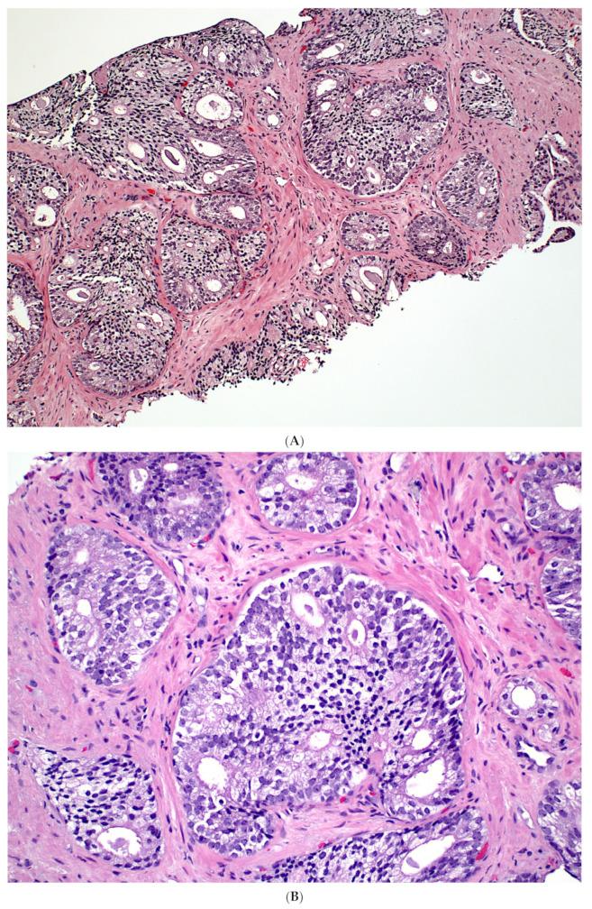 https://cdn.ncbi.nlm.nih.gov/pmc/blobs/42a1/10669759/7aa9ca17d39b/cancers-15-05319-g001a.jpg
