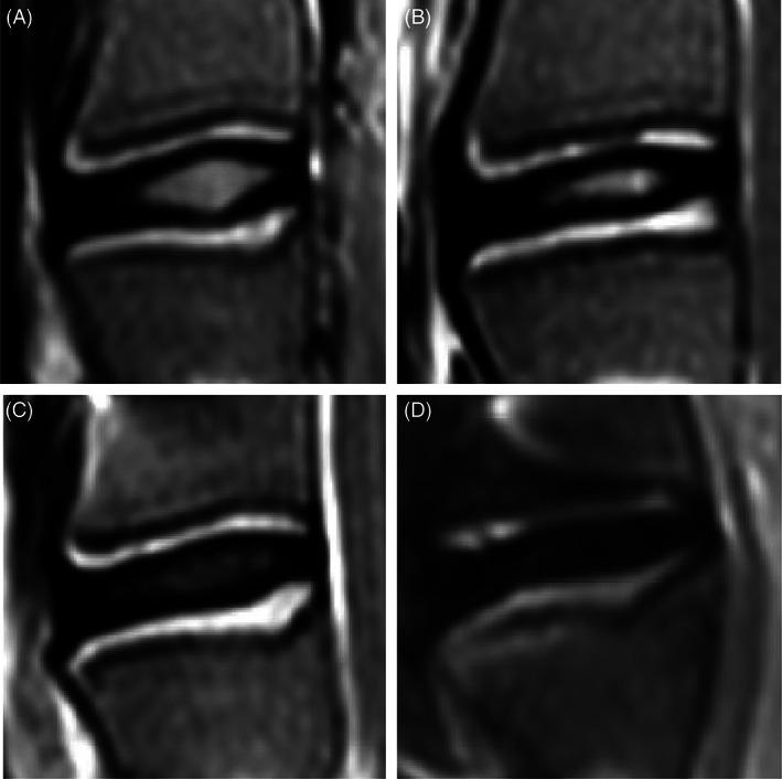 https://cdn.ncbi.nlm.nih.gov/pmc/blobs/42a4/9238284/71b7d7d9c270/JSP2-5-e1198-g007.jpg