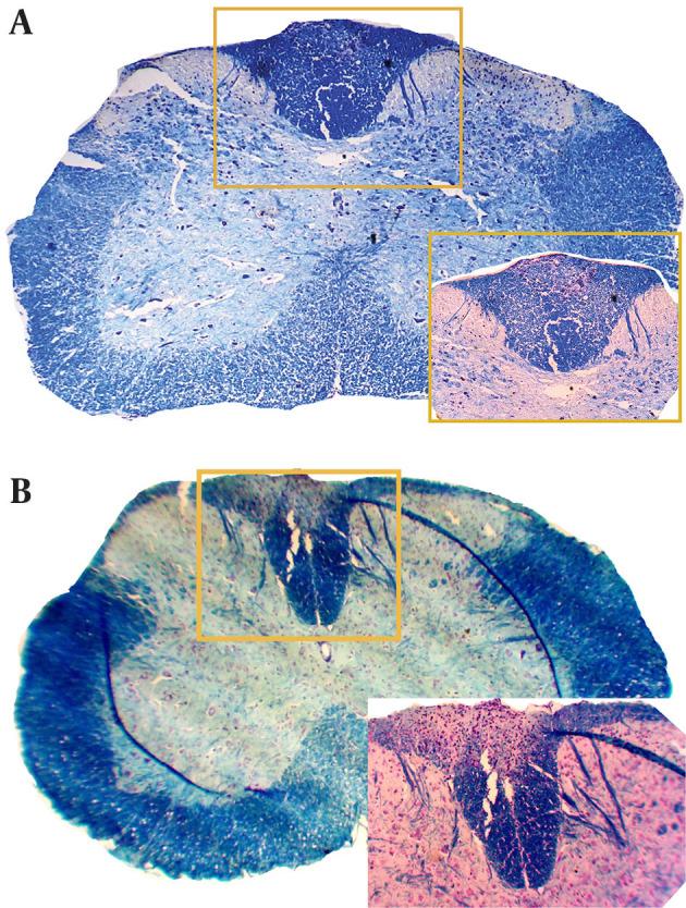 https://cdn.ncbi.nlm.nih.gov/pmc/blobs/42a5/4166093/56bba3a3dfd2/ircmj-16-16956-g001.jpg