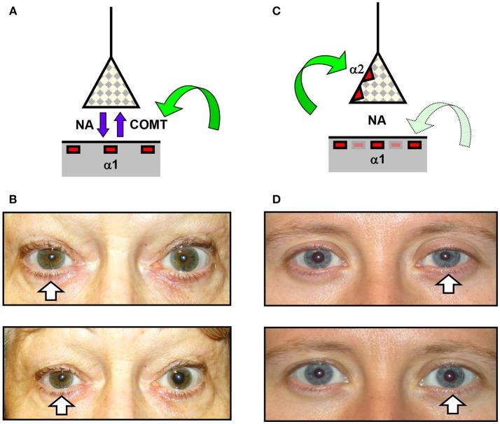 https://cdn.ncbi.nlm.nih.gov/pmc/blobs/42a7/6371044/595c026eb0f1/fneur-10-00055-g0002.jpg
