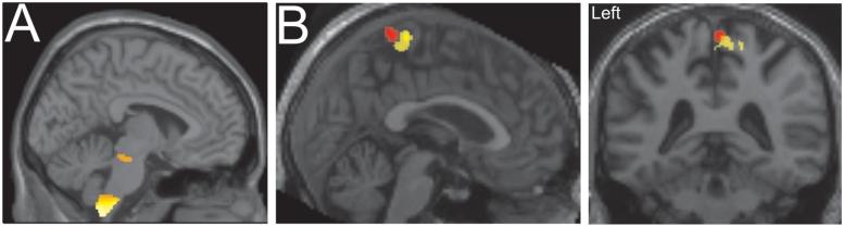 https://cdn.ncbi.nlm.nih.gov/pmc/blobs/42a9/3102242/ece96a846a1c/awr093f2.jpg