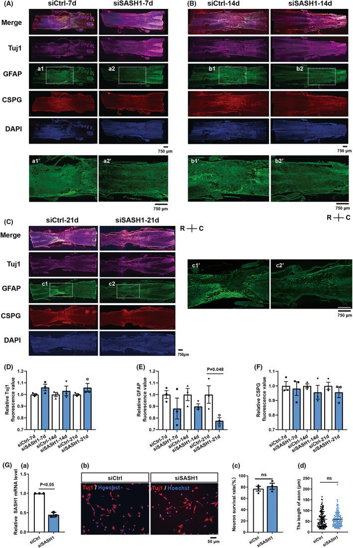 https://cdn.ncbi.nlm.nih.gov/pmc/blobs/42ae/9804067/e8cd94f572e1/CNS-29-228-g004.jpg