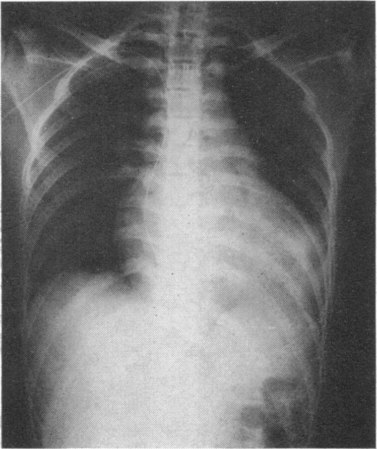 https://cdn.ncbi.nlm.nih.gov/pmc/blobs/42af/487026/1993b1dd32f7/brheartj00295-0076-a.jpg