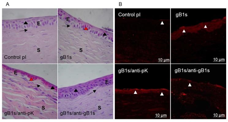 https://cdn.ncbi.nlm.nih.gov/pmc/blobs/42b1/6783931/25fb024b1839/viruses-11-00819-g004.jpg