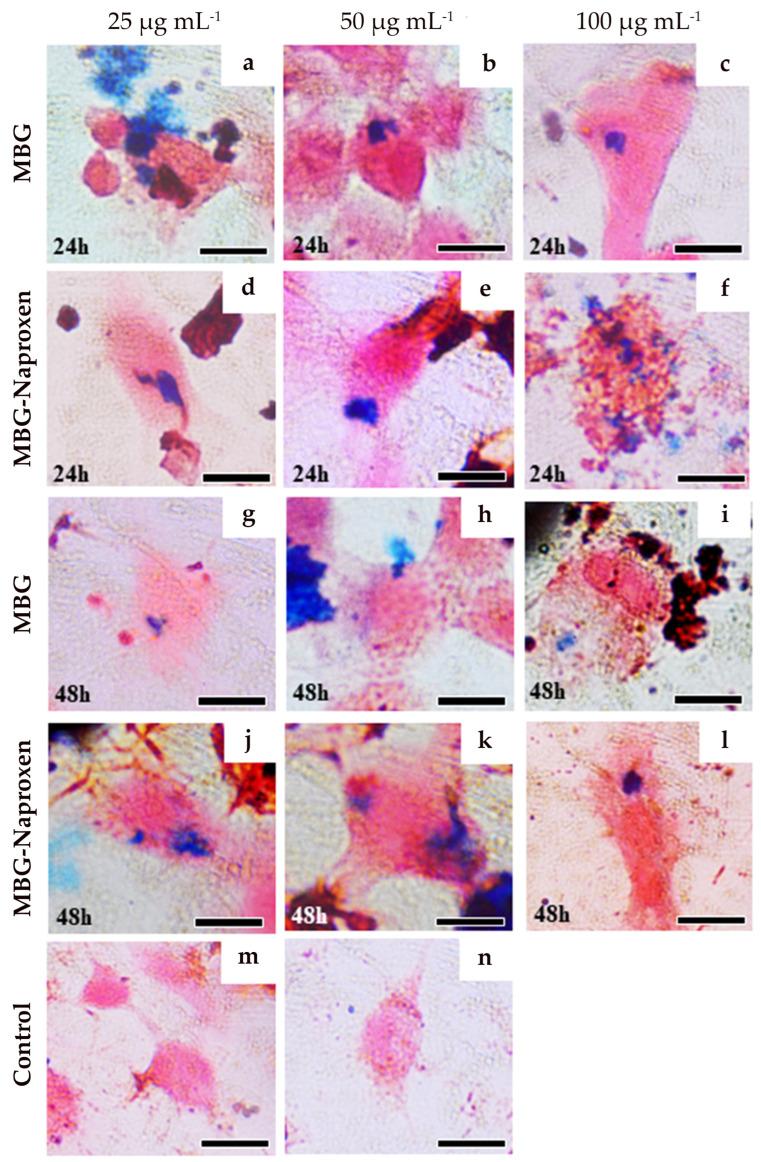 https://cdn.ncbi.nlm.nih.gov/pmc/blobs/42b3/11049812/cffa1cccec18/ijms-25-04270-g011.jpg