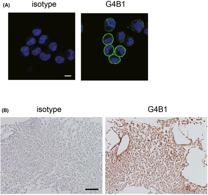 https://cdn.ncbi.nlm.nih.gov/pmc/blobs/42b6/9357664/bcb6224d993c/CAS-113-2878-g002.jpg
