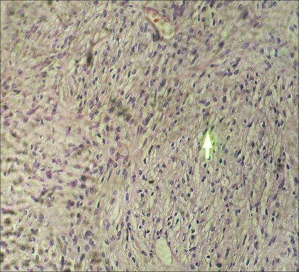 https://cdn.ncbi.nlm.nih.gov/pmc/blobs/42bf/3692190/1101cdd6ab32/DRJ-9-119-g003.jpg