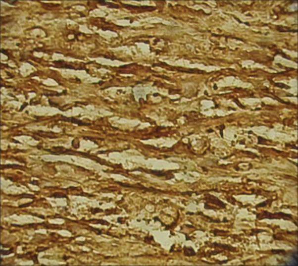 https://cdn.ncbi.nlm.nih.gov/pmc/blobs/42bf/3692190/2e030f71b3a1/DRJ-9-119-g004.jpg