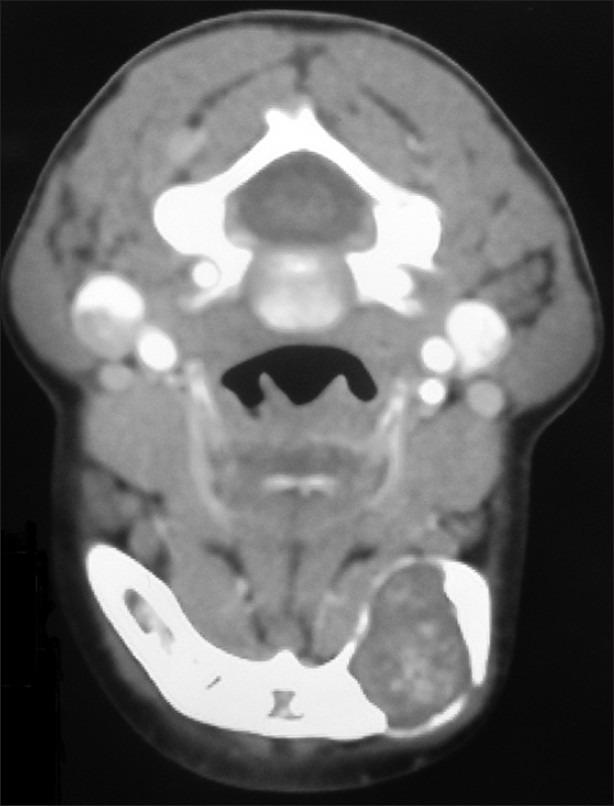 https://cdn.ncbi.nlm.nih.gov/pmc/blobs/42bf/3692190/49f081a81606/DRJ-9-119-g002.jpg