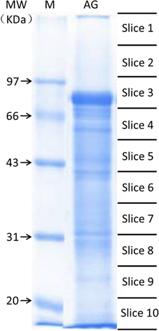 https://cdn.ncbi.nlm.nih.gov/pmc/blobs/42c0/4549300/5deb3e7be860/pone.0136266.g002.jpg