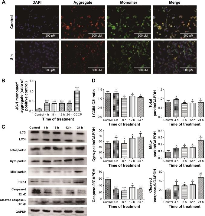 https://cdn.ncbi.nlm.nih.gov/pmc/blobs/42c5/5352242/7b650c43a2c2/ijn-12-1891Fig8.jpg