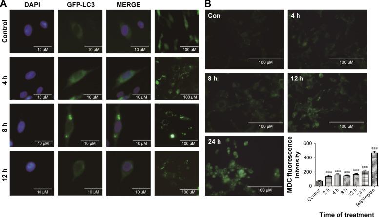 https://cdn.ncbi.nlm.nih.gov/pmc/blobs/42c5/5352242/a9716c390ee2/ijn-12-1891Fig6.jpg