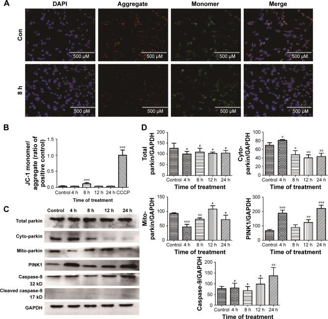 https://cdn.ncbi.nlm.nih.gov/pmc/blobs/42c5/5352242/de7aaa5cd454/ijn-12-1891Fig7.jpg