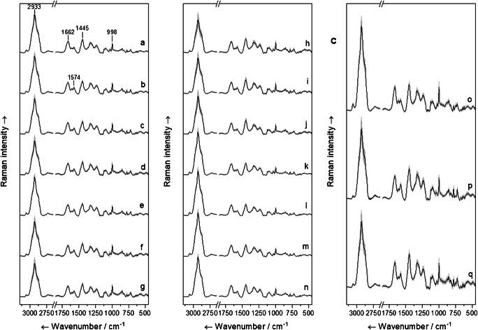 https://cdn.ncbi.nlm.nih.gov/pmc/blobs/42c7/7680742/56d4e9624e71/216_2020_2957_Fig1_HTML.jpg