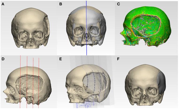 https://cdn.ncbi.nlm.nih.gov/pmc/blobs/42c9/8063040/aa54f2146f65/fphys-12-647923-g0002.jpg