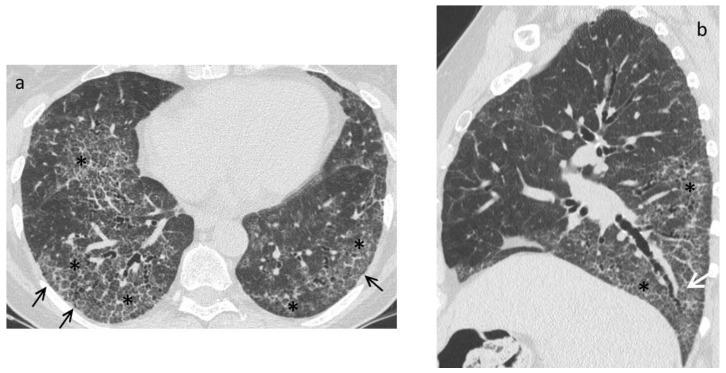 https://cdn.ncbi.nlm.nih.gov/pmc/blobs/42c9/8617987/302b08cb638a/diagnostics-11-01960-g003.jpg