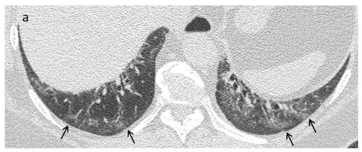 https://cdn.ncbi.nlm.nih.gov/pmc/blobs/42c9/8617987/faaeacdd3f51/diagnostics-11-01960-g002a.jpg