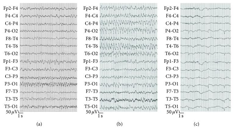 https://cdn.ncbi.nlm.nih.gov/pmc/blobs/42cb/4925940/b451a33035eb/CRINM2016-5913840.001.jpg