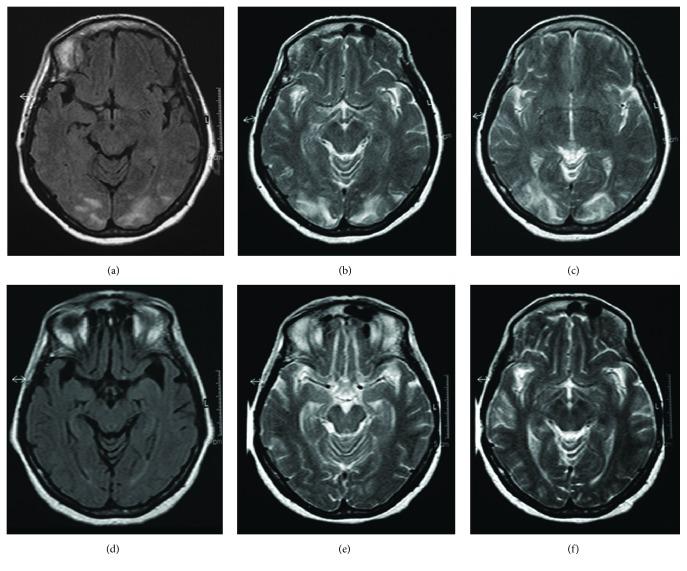 https://cdn.ncbi.nlm.nih.gov/pmc/blobs/42cb/4925940/ce13a6052482/CRINM2016-5913840.002.jpg